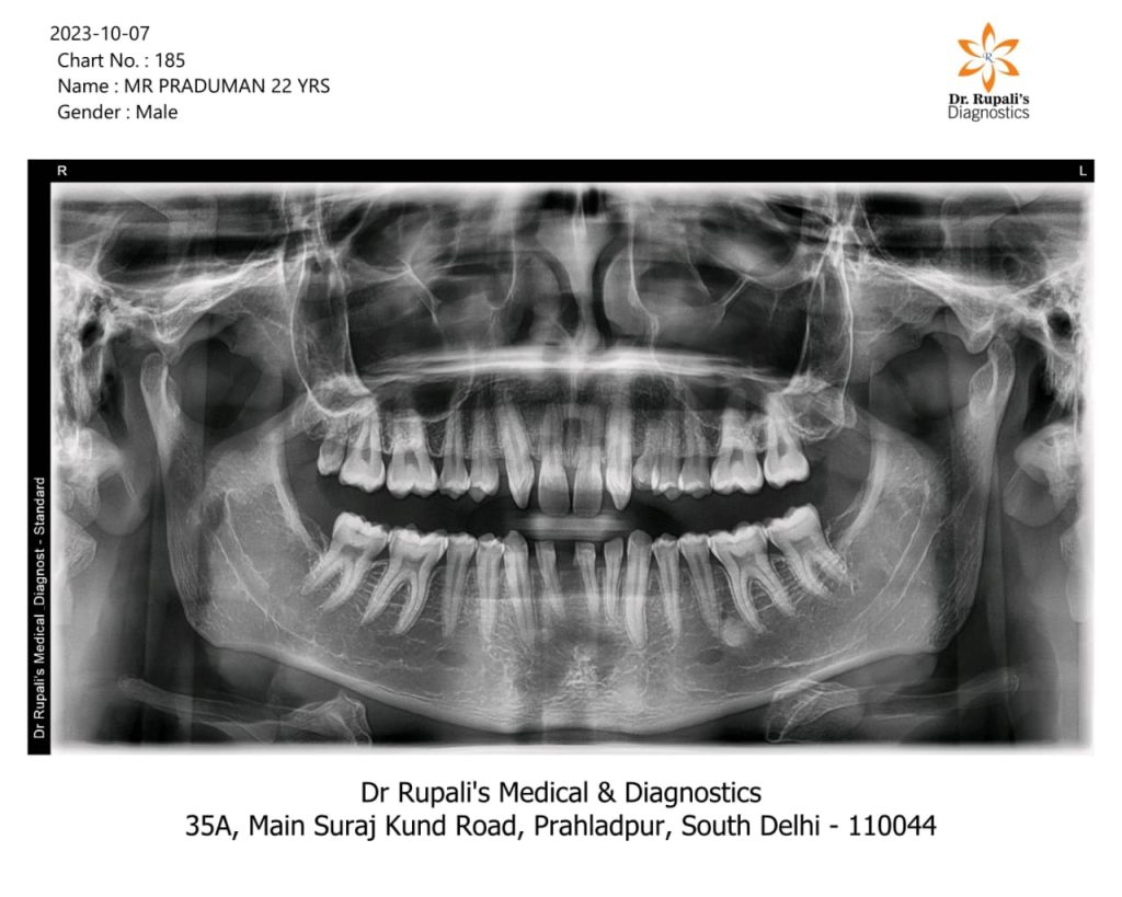 OPG Dental X-Ray taken at Dr. Rupali's Medical & Diagnostics