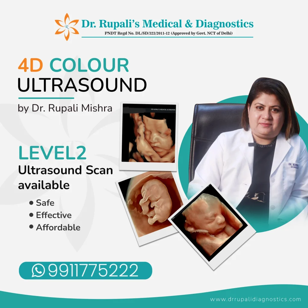 Level2 Ultrasound in South Delhi by Dr. Rupali Mishra