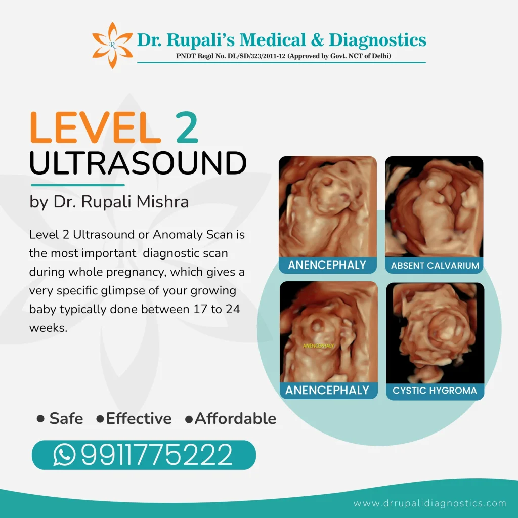 Level 2 Ultrasound